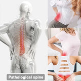 YBAM Lumbar Stretcher Device – Spine Correction & Back Opener Pillow for Lower Back Pain Relief, Yoga & Chiropractic Support